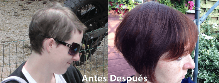 foto antes y después rebrote pelo mujer